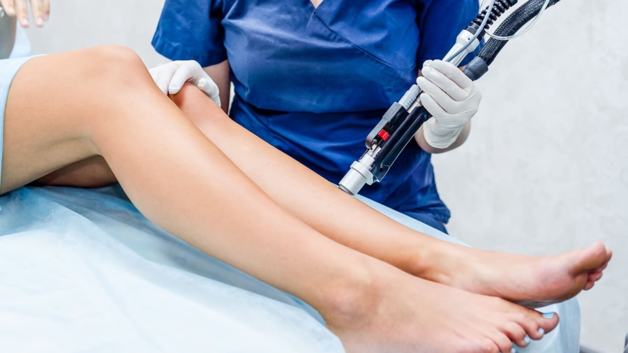 laser-hair-removal-
