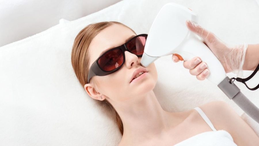 laser-hair-removal-face